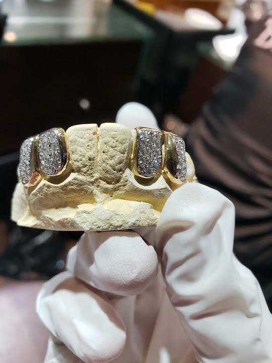 Atlanta Custom Gold Grills