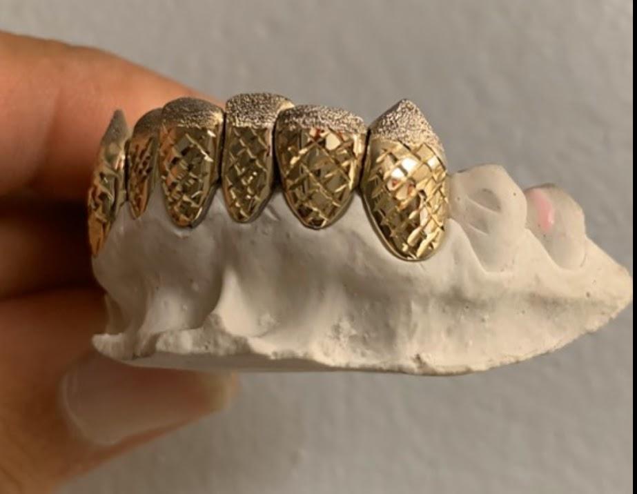 Finesse Grillz